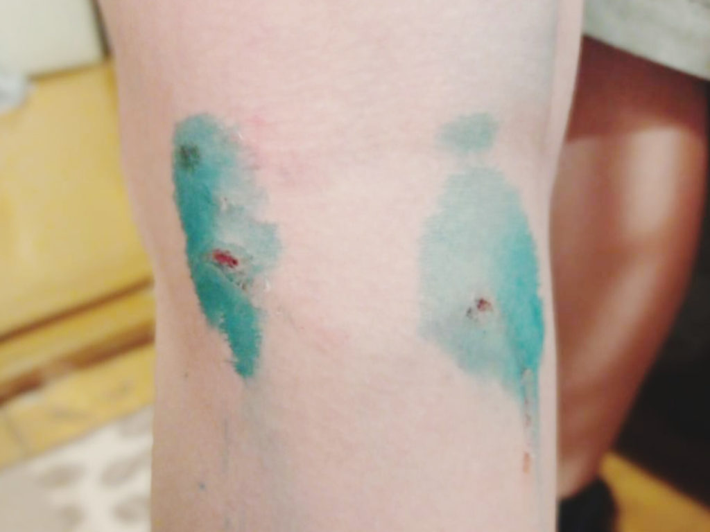 После очередного искусанного бродячими собаками ребенка, прокуратура подала в суд на администрацию Копейска