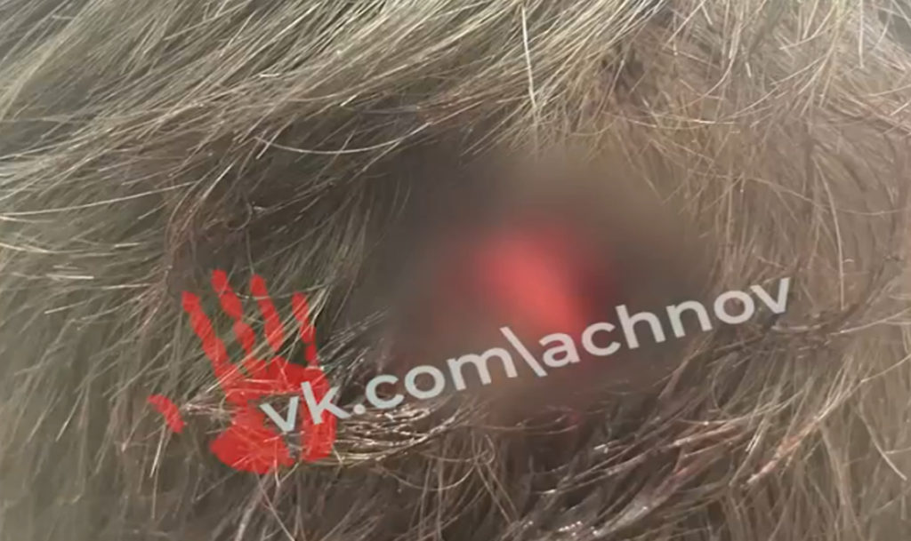 “Ни за что пнул девушку и в друга стрелял просто так, у него ранение в ногу и голову”