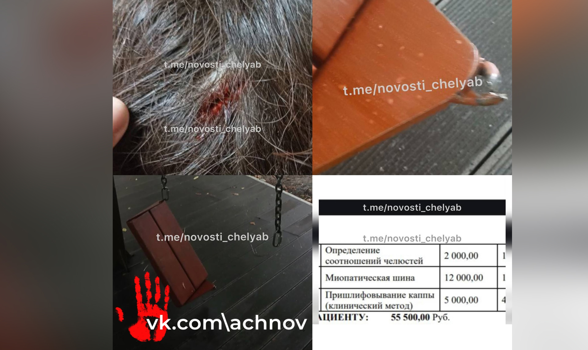 Прокуратура начала проверку по поводу безопасности игрового оборудования в челябинском парке имени Пушкина