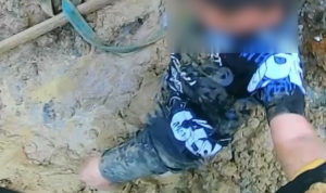 Любовь к чипсам чуть не оставила мальчика без ноги!