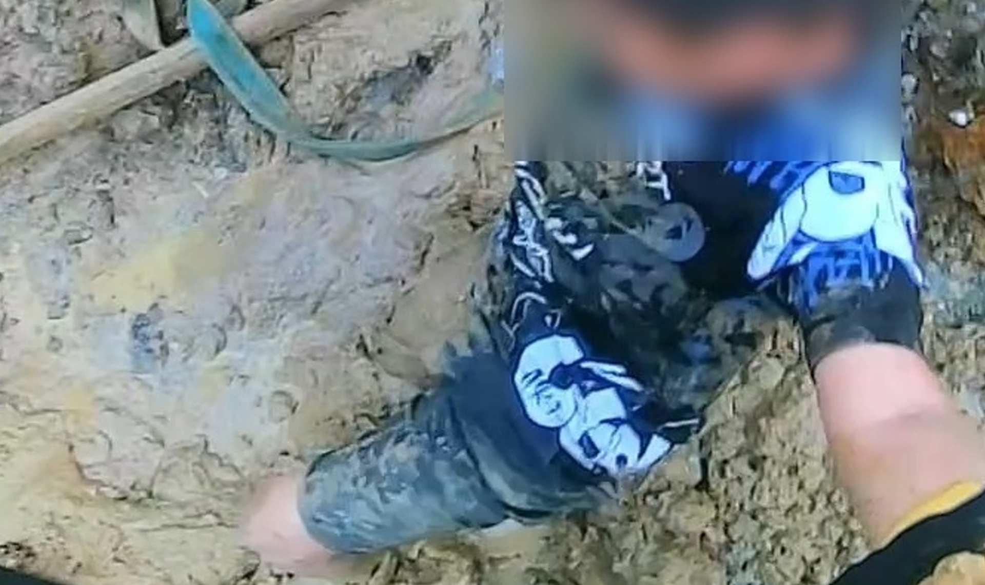 Любовь к чипсам чуть не оставила мальчика без ноги!