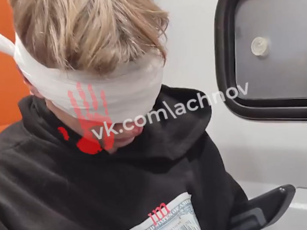 В Челябинске подросток выстрелил из ракетницы в лицо другому школьнику