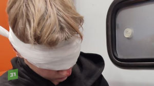 Подростку выстрелили в лицо