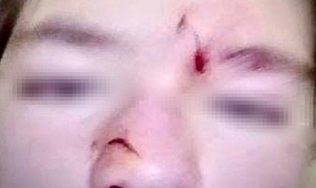 Семья школьника, которому собака могла разорвать лицо, получит компенсацию