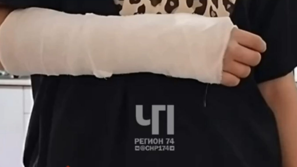 В СК возбудили уголовное дело по факту нападения двух алабаев на девочку в Першино