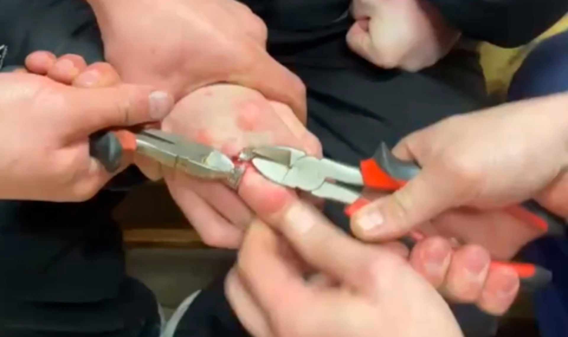 Разрезали с ювелирной точностью! Спасатели Троицка освободили южноуральца от кольца