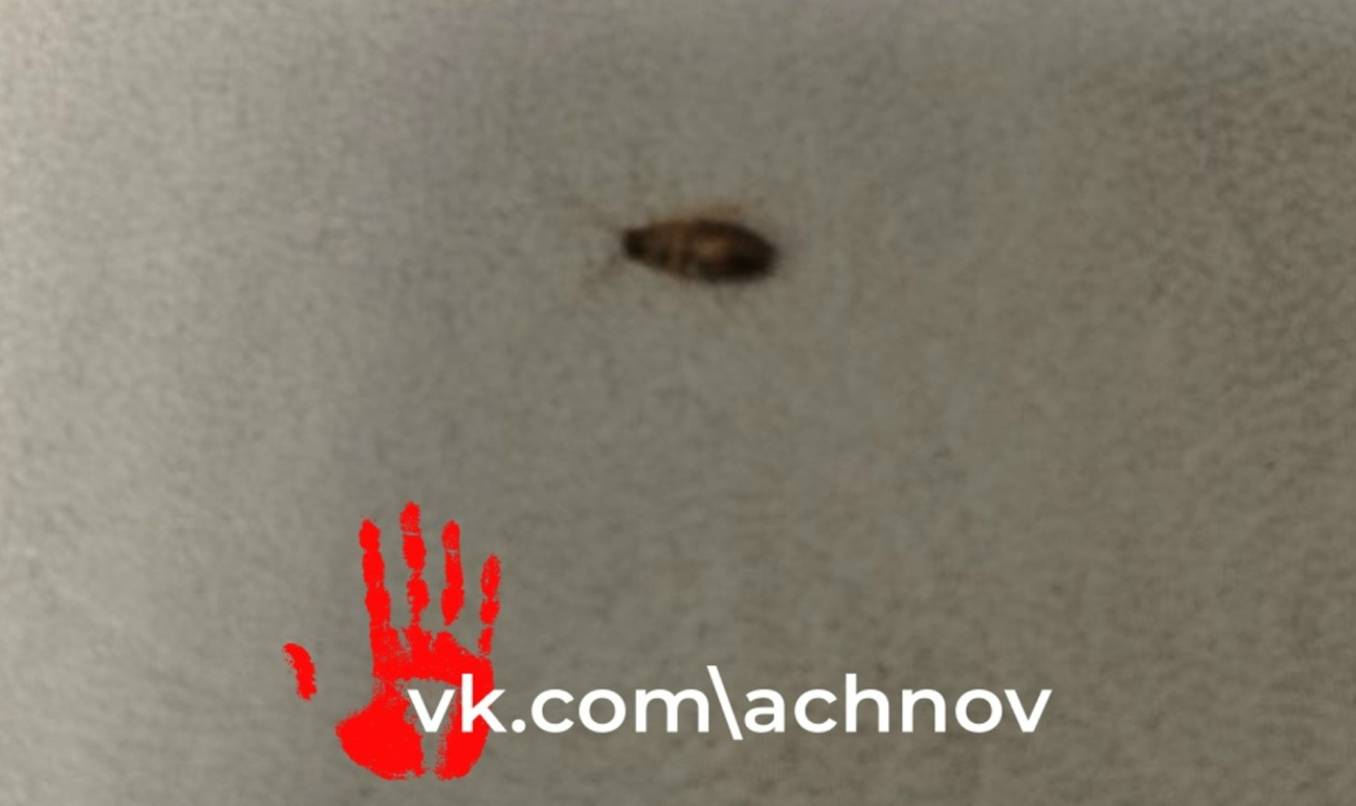 Пришел в больницу без таракан, а ушел с насекомым!